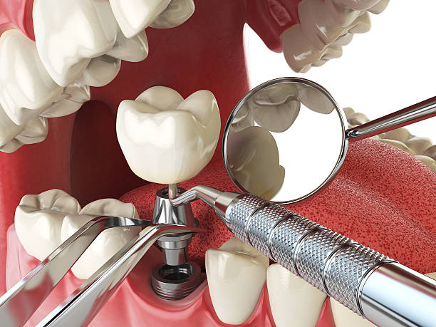 Best Emergency Dental Extractions in Versailles, PA