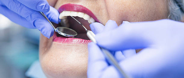 Best Emergency Dental Extractions in Versailles, PA